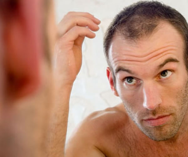 Como evitar a queda de cabelo em homens?